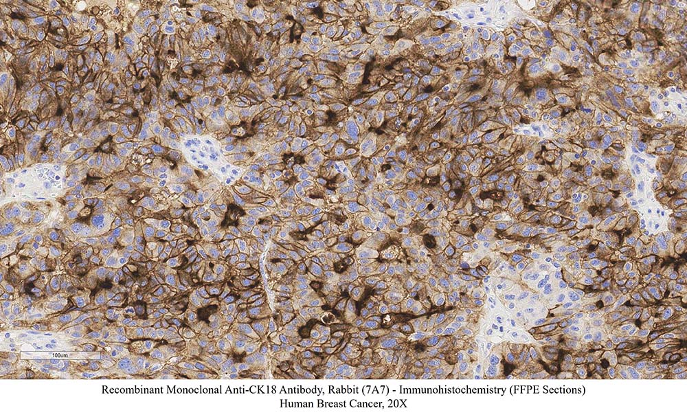 CK18 SAMPLE STAINING DATA