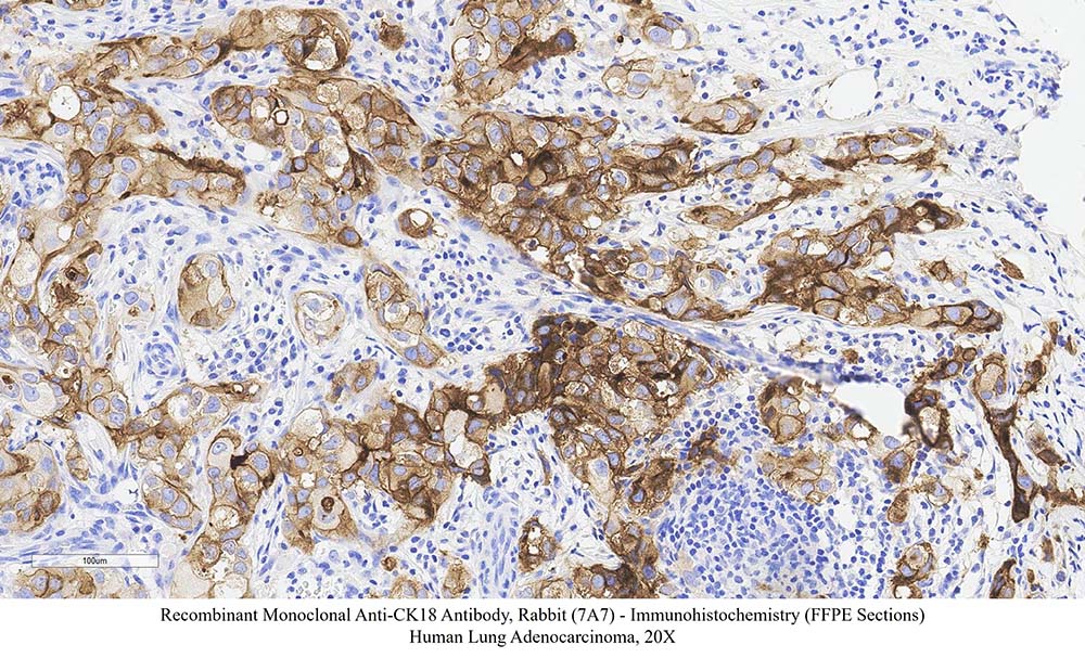 CK18 SAMPLE STAINING DATA