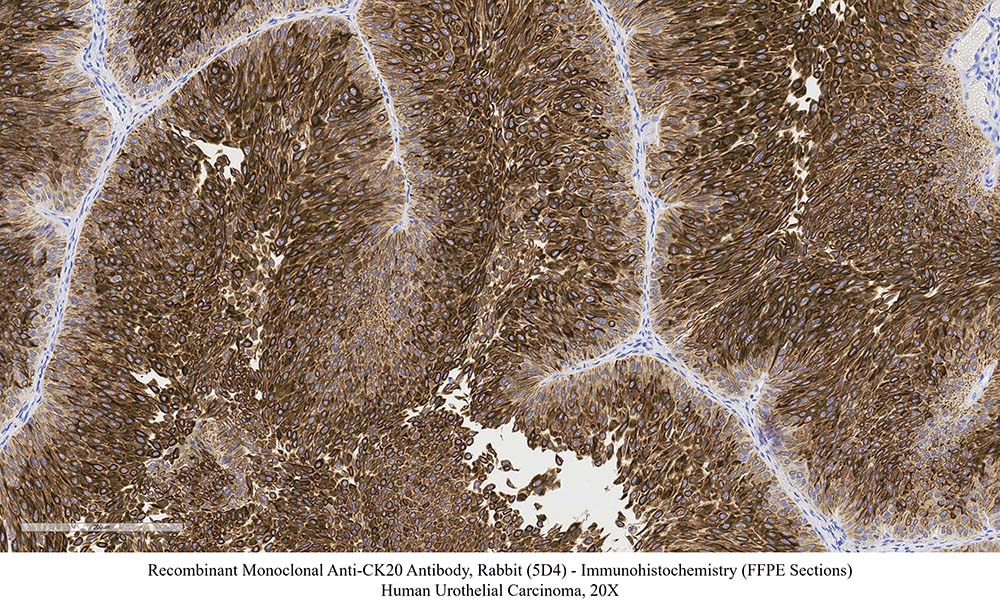 CK20 SAMPLE STAINING DATA
