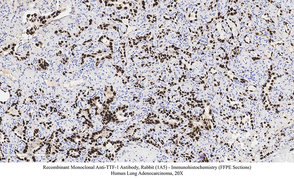 TTF-1 SAMPLE STAINING DATA