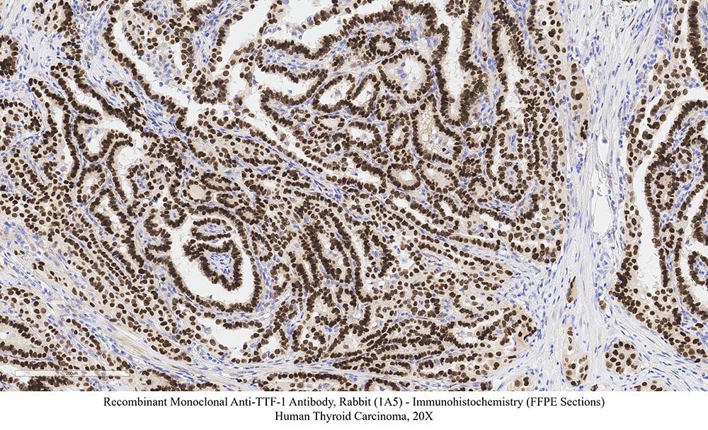 TTF-1 SAMPLE STAINING DATA