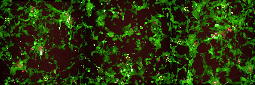 Alpha-Synuclein CELL