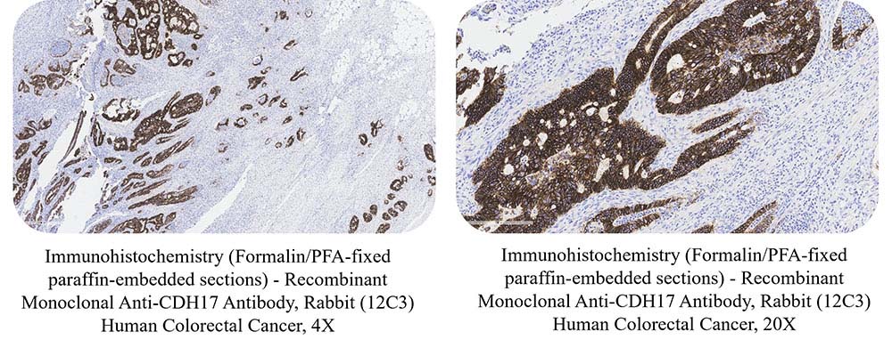 Recombinant Monoclonal Anti-CDH17 Antibody, Rabbit (12C3) | ACROBiosystems