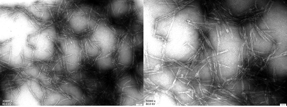 Alpha-Synuclein ELECTRON MICROSCOPE