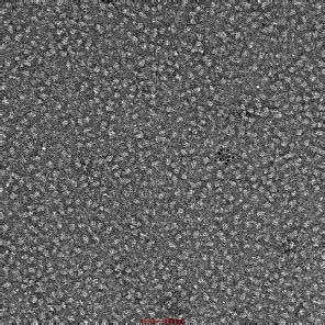 Spike protein ELECTRON MICROSCOPE
