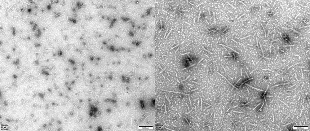 Tau ELECTRON MICROSCOPE