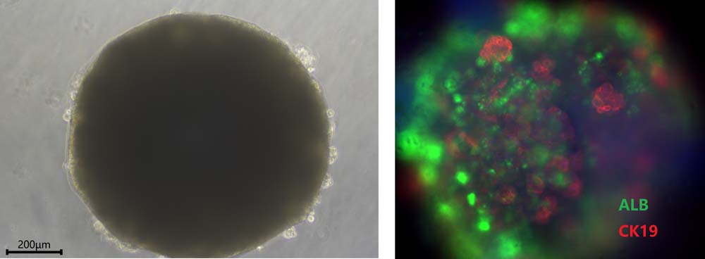 Oncostatin M ORGANOID CULTURE