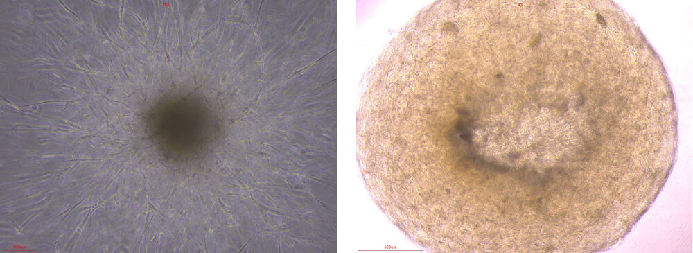 VEGF110 ORGANOID CULTURE