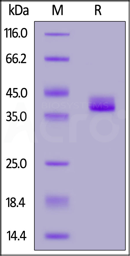 Apolipoprotein E SDS-PAGE