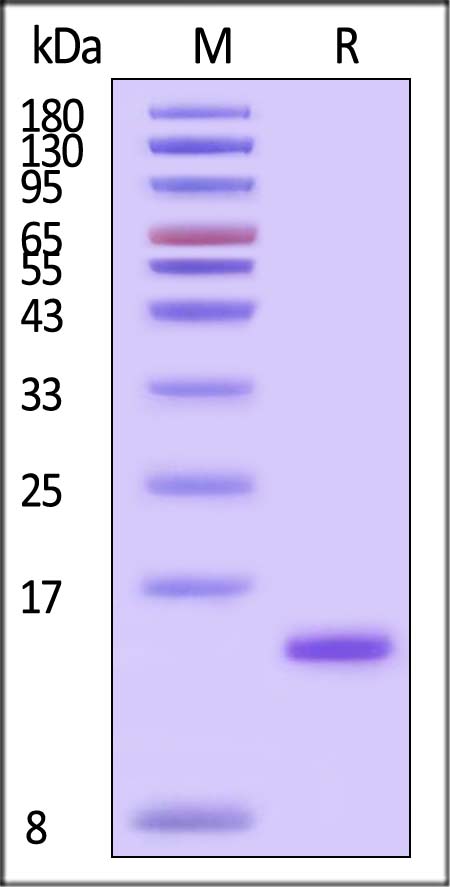 beta 2-Microglobulin SDS-PAGE