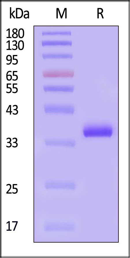 Carbonic Anhydrase IV SDS-PAGE
