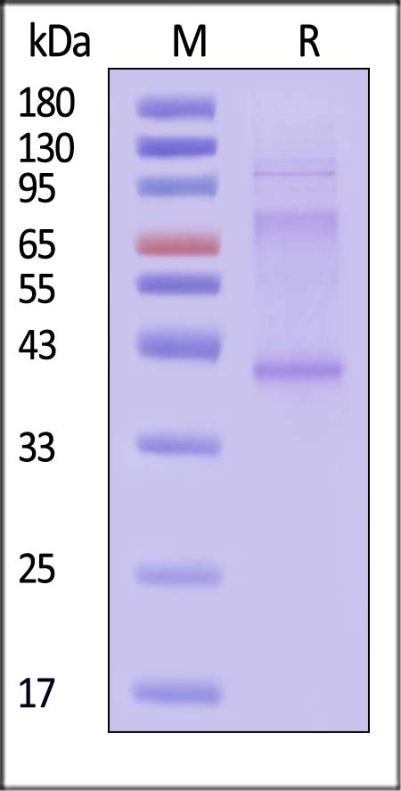 CCR6 SDS-PAGE