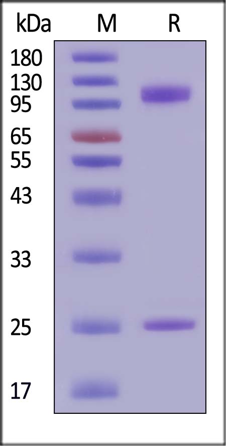 CD133 SDS-PAGE