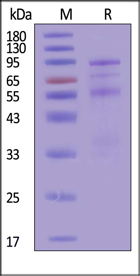 Complement C1s-1 SDS-PAGE