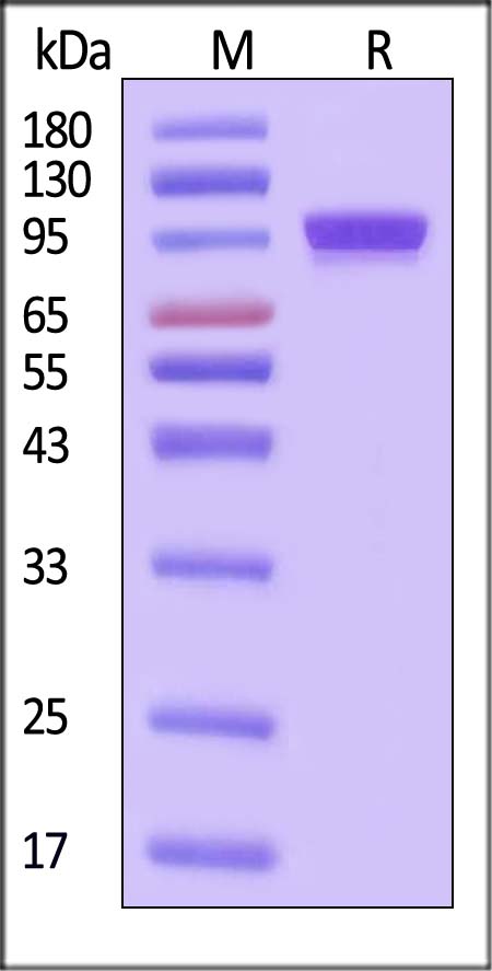 Complement C2 SDS-PAGE