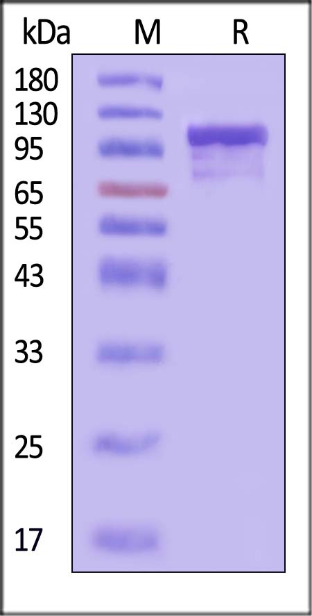 Complement C2 SDS-PAGE