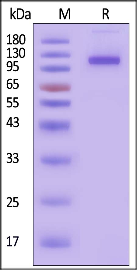 ENPP1 SDS-PAGE