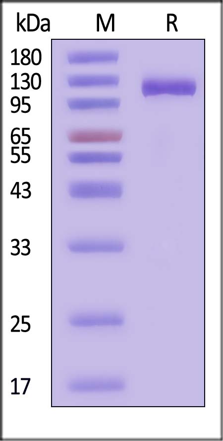 ENPP3 SDS-PAGE