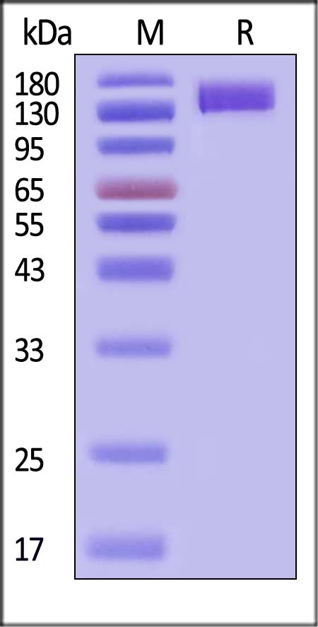 ENPP3 SDS-PAGE