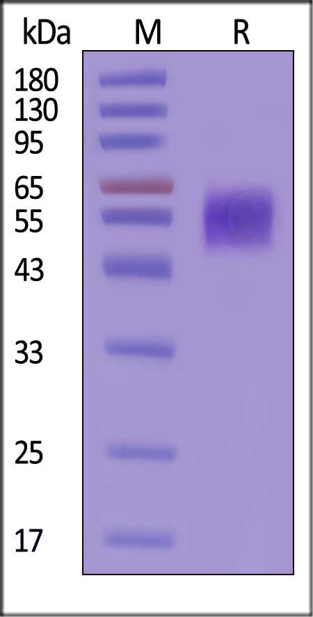 ENPP3 SDS-PAGE