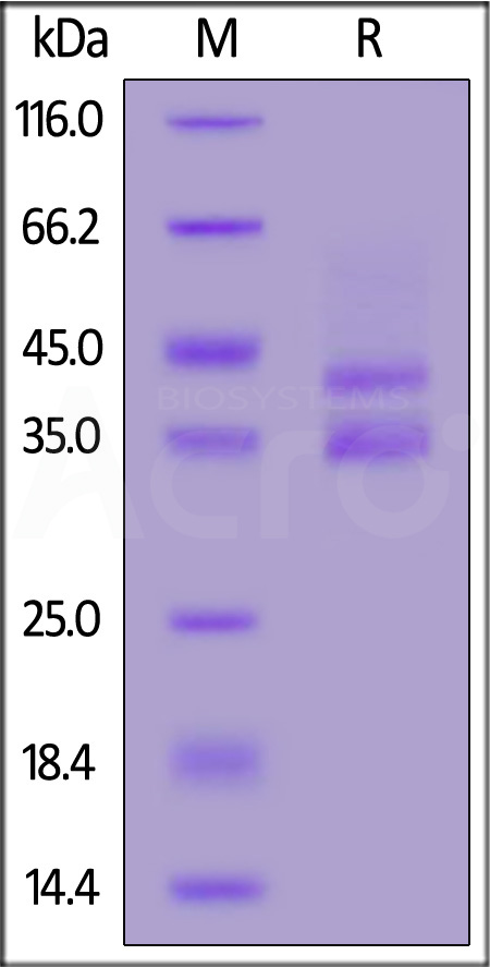 Gastrin-71 SDS-PAGE