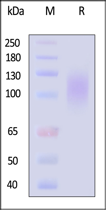 Envelope glycoprotein gp120/gp120 (HIV) SDS-PAGE