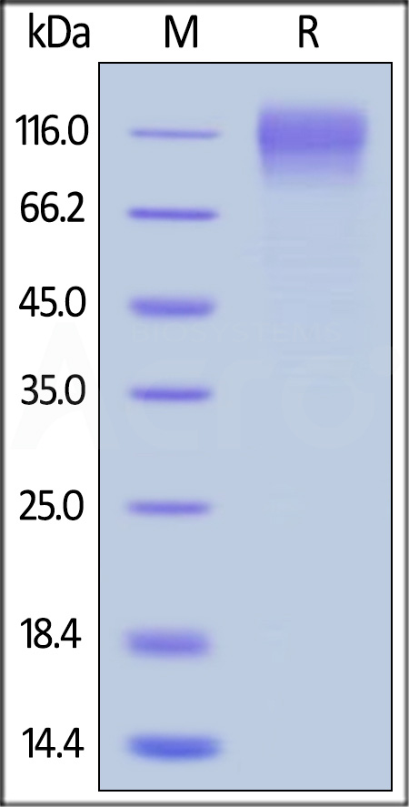 Envelope glycoprotein gp120/gp120 (HIV) SDS-PAGE