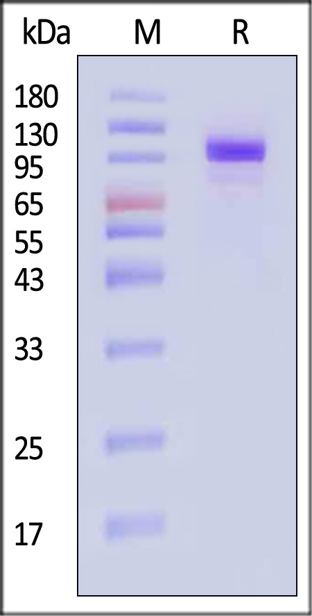 Hemagglutinin/HA (Influenza Virus) SDS-PAGE