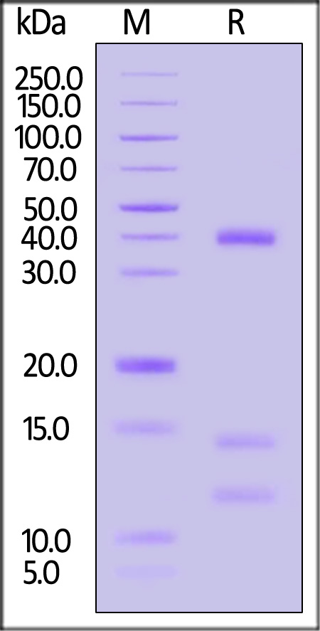 HLA-A*1101 & B2M & KRASG12D (VVGADGVGK) SDS-PAGE
