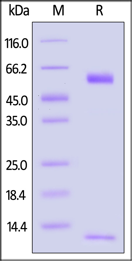 HLA-A*1101 & B2M & KRASG12D (VVGADGVGK) SDS-PAGE