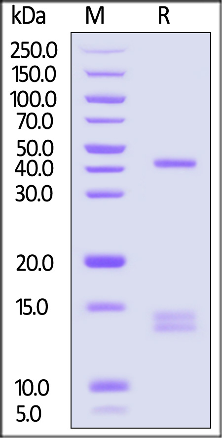 HLA-A*02:01 & B2M & Glypican 3 (FVGEFFTDV) SDS-PAGE