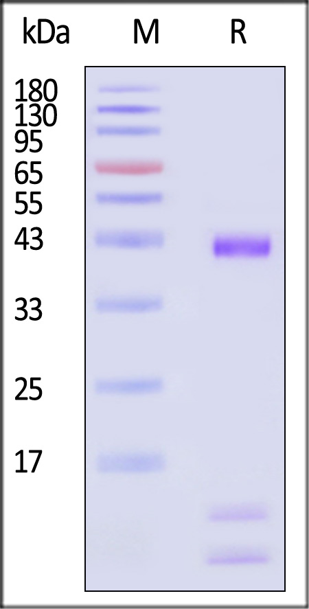 HLA-A*0201 & B2M & p53 (HMTEVVRRC) SDS-PAGE