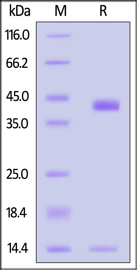 HLA-C*07:02:01 & B2M & RYR (RYRPGTVAL) SDS-PAGE