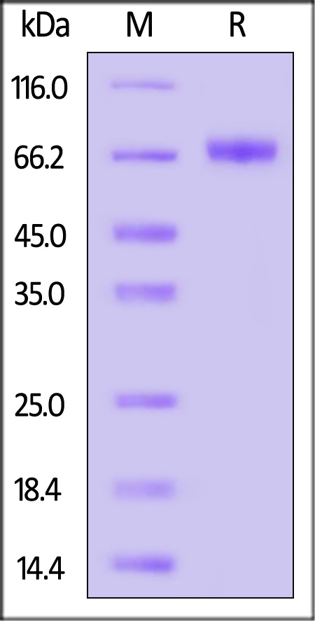 Hemagglutinin-neuraminidase/HN (MuV) SDS-PAGE