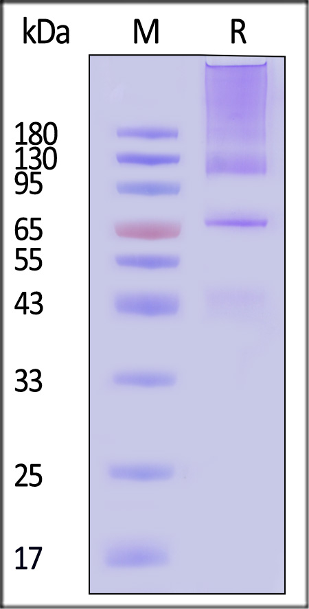 Serum Albumin SDS-PAGE