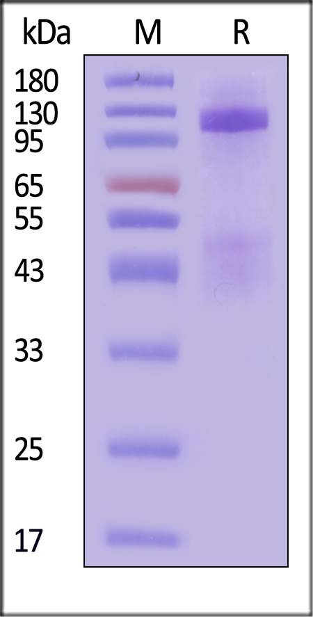 IGF-I R SDS-PAGE