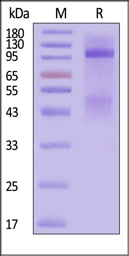 IGF-I R SDS-PAGE