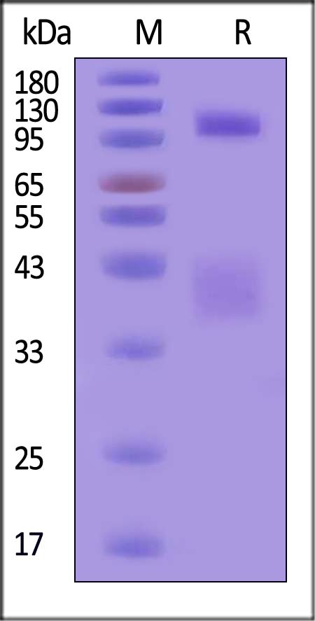 IGF-I R / IGF-1 R SDS-PAGE