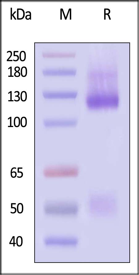 IGF-I R / IGF-1 R SDS-PAGE