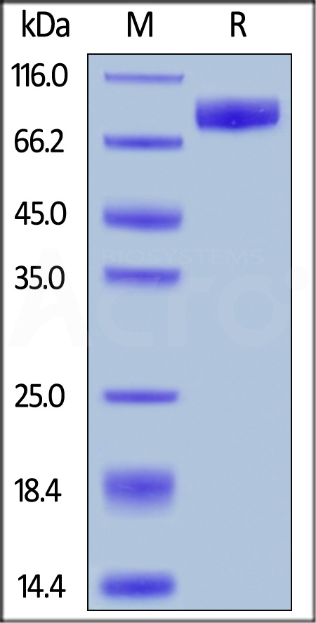 IL-1 Rrp2 SDS-PAGE