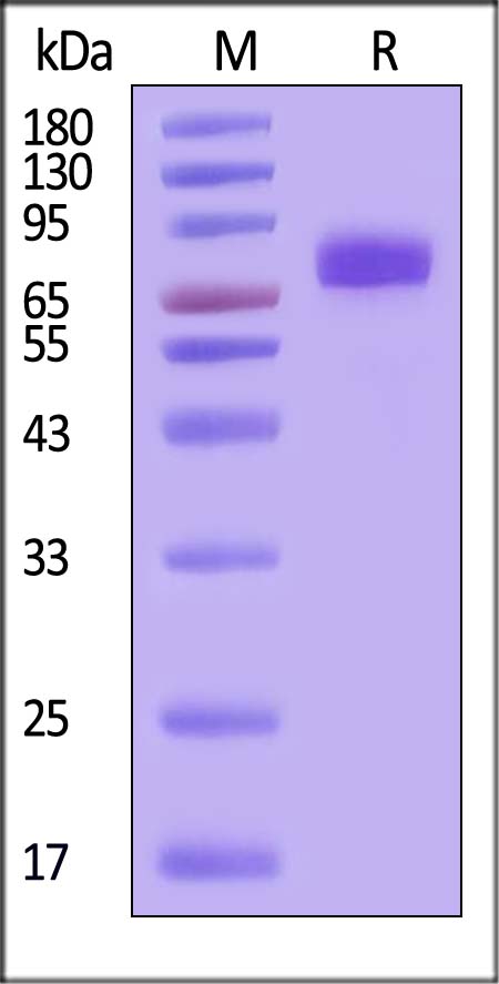 IL-6 R alpha & IL-6 SDS-PAGE