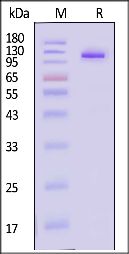 IL-12 R beta 1 SDS-PAGE