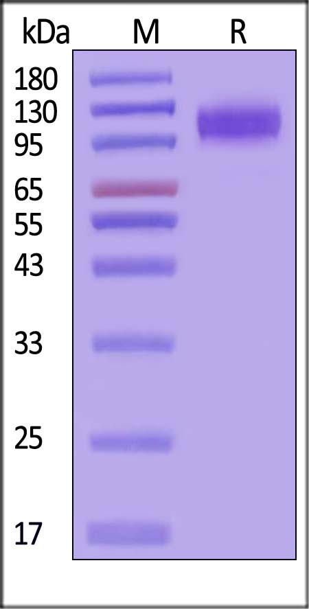 IL-12 R beta 2 SDS-PAGE