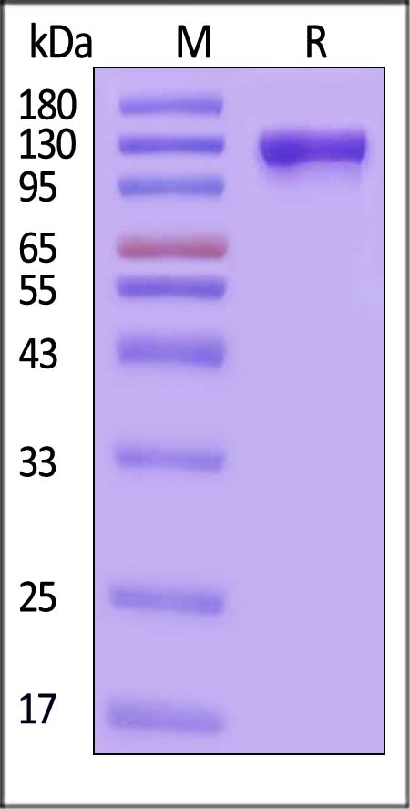 IL-6 R beta SDS-PAGE