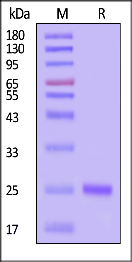 invasin SDS-PAGE