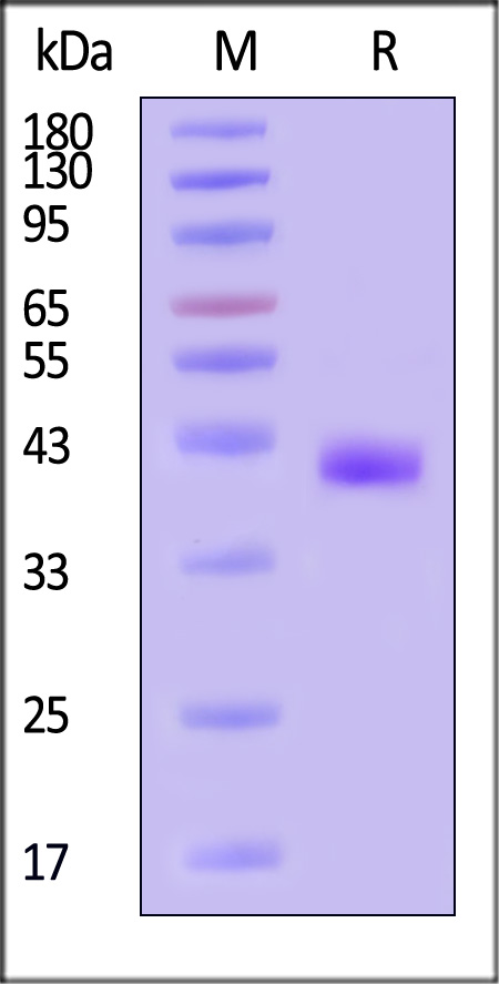 ITPRIPL1 SDS-PAGE