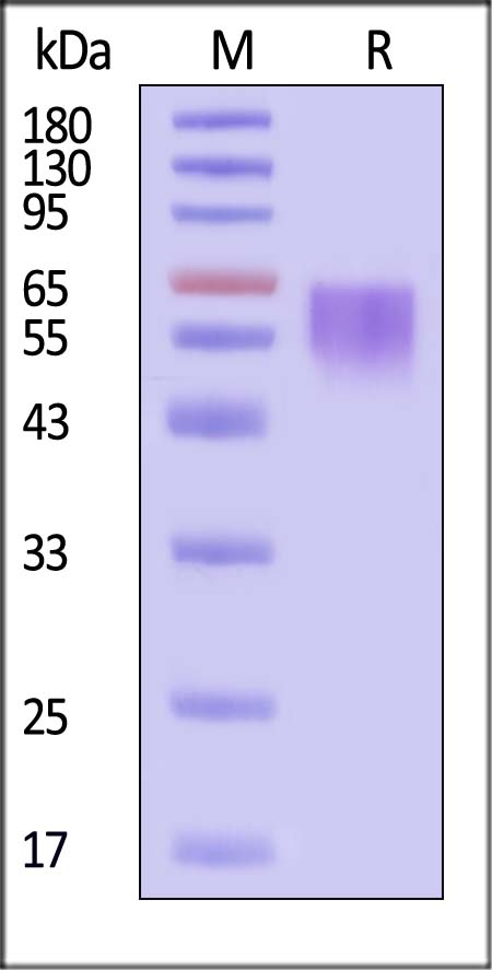 TIM-1 SDS-PAGE
