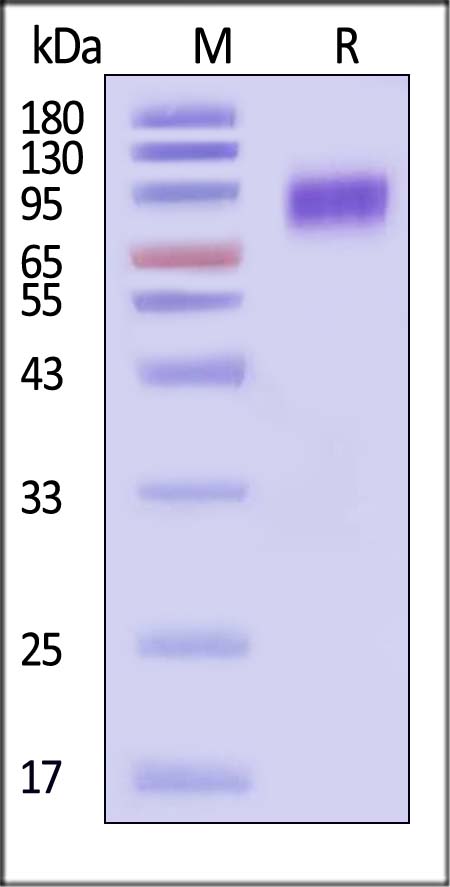 Neuraminidase/NA (Influenza Virus) SDS-PAGE