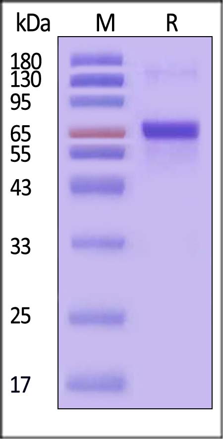 Neuraminidase/NA (Influenza Virus) SDS-PAGE