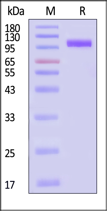 NCAM-1 SDS-PAGE